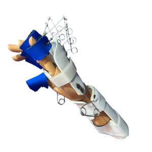 FERULA ACTIVA PARA EXTENSION DE DEDOS ARTICULADA